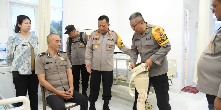 Kapolda Maluku Berikan Bantuan Kaki Palsu untuk Anggota Polri