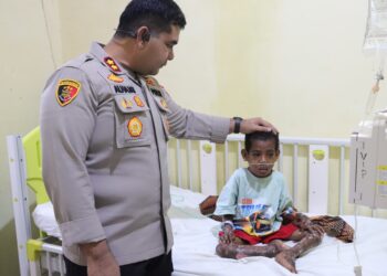 Kapolres SBT Jenguk Anak Penderita Kusta dan Gizi Buruk, Beri Bantuan Hingga Donor Darah