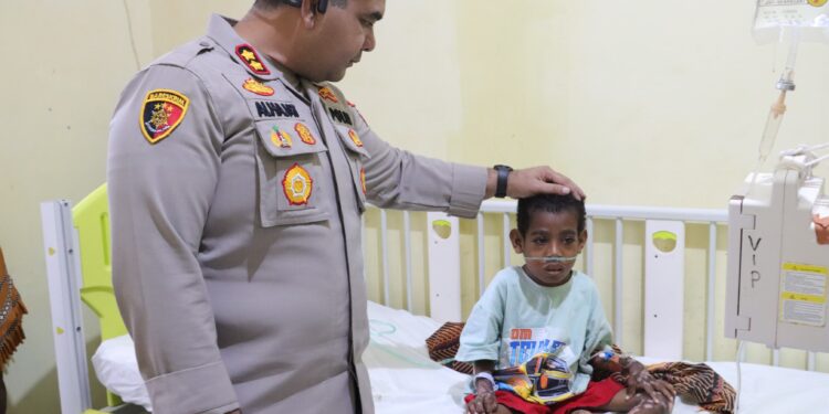 Kapolres SBT Jenguk Anak Penderita Kusta dan Gizi Buruk, Beri Bantuan Hingga Donor Darah
