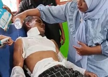 Empat Aktivis PMII Terbakar Saat Unjuk Rasa di DPRD SBT