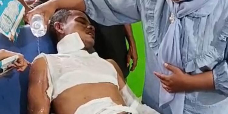 Empat Aktivis PMII Terbakar Saat Unjuk Rasa di DPRD SBT