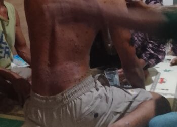 Abdullah Mahu Dianiaya Hingga Luka Berat, FSBM Minta Polda Maluku Gerak Cepat
